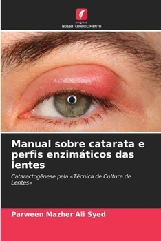 Paperback Manual sobre catarata e perfis enzimáticos das lentes [Portuguese] Book