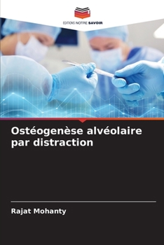 Paperback Ostéogenèse alvéolaire par distraction [French] Book