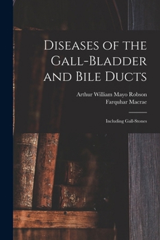 Paperback Diseases of the Gall-Bladder and Bile Ducts: Including Gall-Stones Book