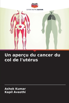 Un aperçu du cancer du col de l'utérus (French Edition)