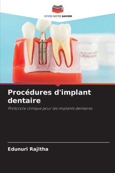 Paperback Procédures d'implant dentaire [French] Book