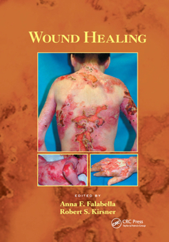 Paperback Wound Healing Book