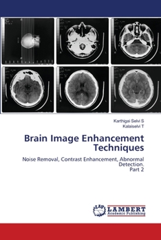 Paperback Brain Image Enhancement Techniques Book