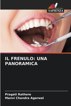 Paperback Il Frenulo: Una Panoramica [Italian] Book