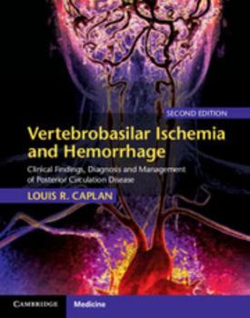 Hardcover Vertebrobasilar Ischemia and Hemorrhage: Clinical Findings, Diagnosis and Management of Posterior Circulation Disease Book