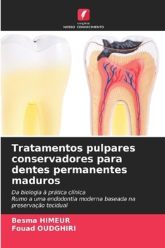 Tratamentos pulpares conservadores para dentes permanentes maduros (Portuguese Edition)
