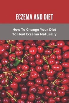 Eczema And Diet: How To Change Your Diet To Heal Eczema Naturally: How To Treat Eczema With Diet