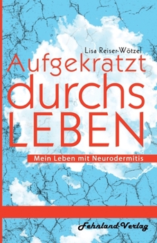 Paperback Aufgekratzt durchs Leben. Mein Leben mit Neurodermitis [German] Book