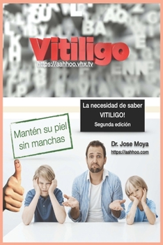 Paperback La necesidad de saber VITILIGO: Segunda edición [Spanish] Book