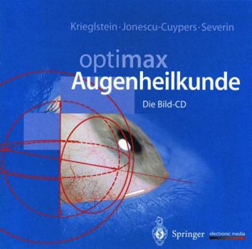Hardcover Optimax Augenheilkunde: Die Bild-CD [German] Book