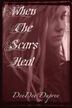 Paperback When The Scars Heal Book