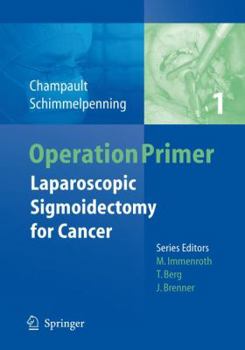 Paperback Laparoscopic Sigmoidectomy for Cancer Book