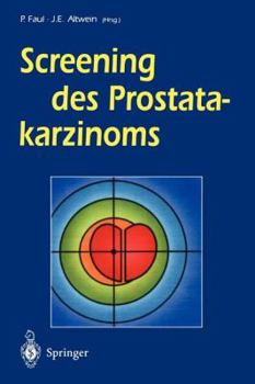 Paperback Screening Des Prostatakarzinoms [German] Book