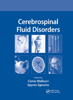 Paperback Cerebrospinal Fluid Disorders Book