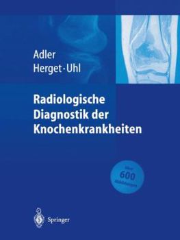 Paperback Radiologische Diagnostik Der Knochenkrankheiten [German] Book