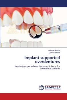 Paperback Implant supported overdentures Book