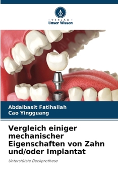 Paperback Vergleich einiger mechanischer Eigenschaften von Zahn und/oder Implantat [German] Book