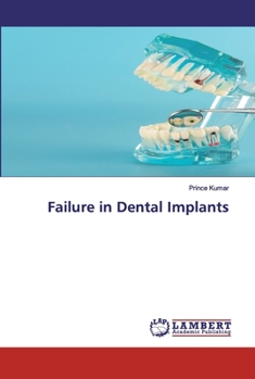 Paperback Failure in Dental Implants Book