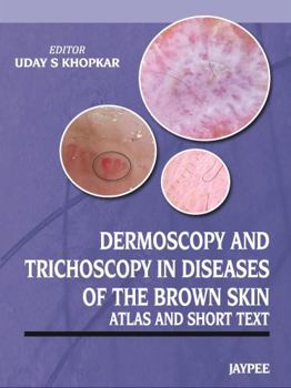 Dermoscopy and Trichoscopy in Diseases of the Brown Skin: Atlas and Short Text
