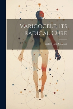 Paperback Varicocele, Its Radical Cure Book