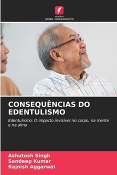 Paperback Consequências Do Edentulismo [Portuguese] Book