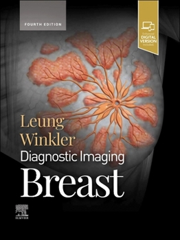 Hardcover Diagnostic Imaging: Breast Book