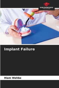 Paperback Implant Failure Book