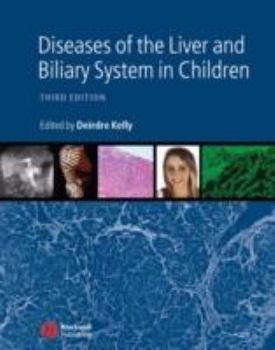 Hardcover Diseases of the Liver and Biliary System in Children Book