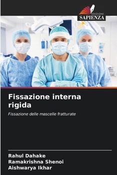 Fissazione interna rigida: Fissazione delle mascelle fratturate (Italian Edition)