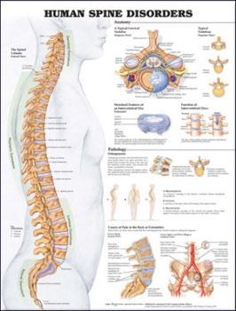 Misc. Human Spine Disorders Anatomical Chart Book