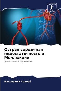 Paperback Острая сердечная недост& [Russian] Book