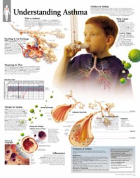 Misc. Understanding Asthma Chart: Laminated Wall Chart Book