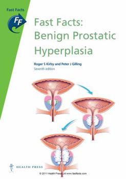 Paperback Fast Facts: Benign Prostatic Hyperplasia Book