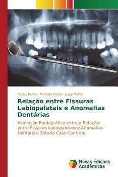 Paperback Relação entre Fissuras Labiopalatais e Anomalias Dentárias [Portuguese] Book