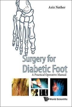 Paperback Surgery for Diabetic Foot: A Practical Operative Manual Book