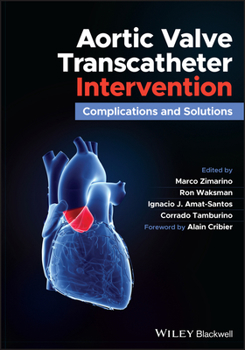 Hardcover Aortic Valve Transcatheter Intervention: Complications and Solutions Book
