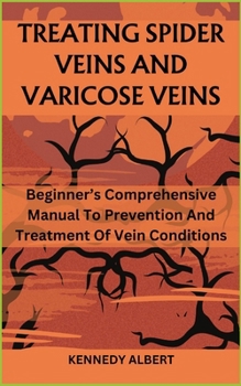 Paperback TREATING SPIDER VEINS AND VARICOSE VEINS: Beginner’s Comprehensive Manual To Prevention And Treatment Of Vein Conditions Book