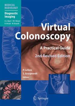 Hardcover Virtual Colonoscopy: A Practical Guide Book