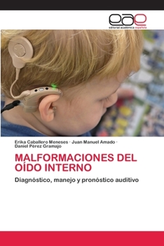 Paperback Malformaciones del Oído Interno [Spanish] Book