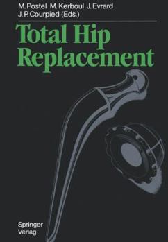 Paperback Total Hip Replacement Book