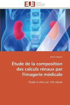 Paperback Étude de la Composition Des Calculs Rénaux Par l'Imagerie Médicale [French] Book