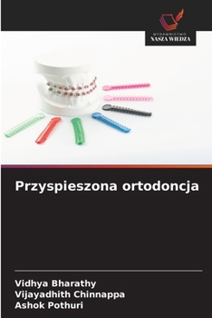 Paperback Przyspieszona ortodoncja [Polish] Book
