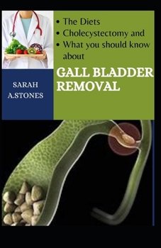 Paperback The Diets, Cholecystectomy, And What You Should Know About Gall Bladder Removal Book