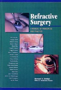 Hardcover Refractive Surgery: A Manual of Principles and Practice Book