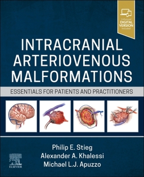Hardcover Intracranial Arteriovenous Malformations: Essentials for Patients and Practitioners Book