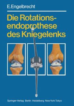 Paperback Die Rotationsendoprothese Des Kniegelenks [German] Book