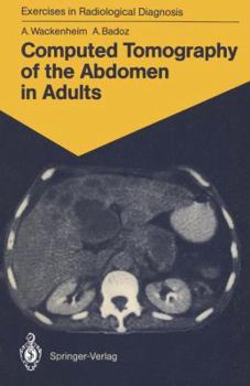 Paperback Computed Tomography of the Abdomen in Adults: 85 Radiological Exercises for Students and Practitioners Book