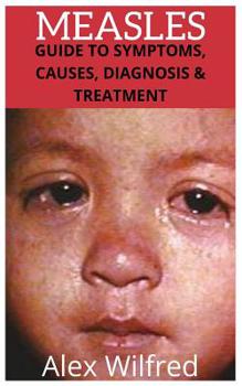 Paperback Measles: Guide to Symptoms, Causes, Diagnosis & Treatment Book