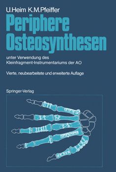 Periphere Osteosynthesen: Unter Verwendung Des Kleinfragment-Instrumentariums Der Ao