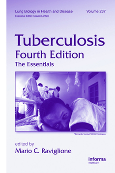 Hardcover Tuberculosis: The Essentials, Fourth Edition Book